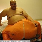 Saúde - Homem passa por cirurgia para reduzir testículos que pesam 63 kg Saúde - Homem passa por cirurgia para reduzir testículos que pesam 63 kg